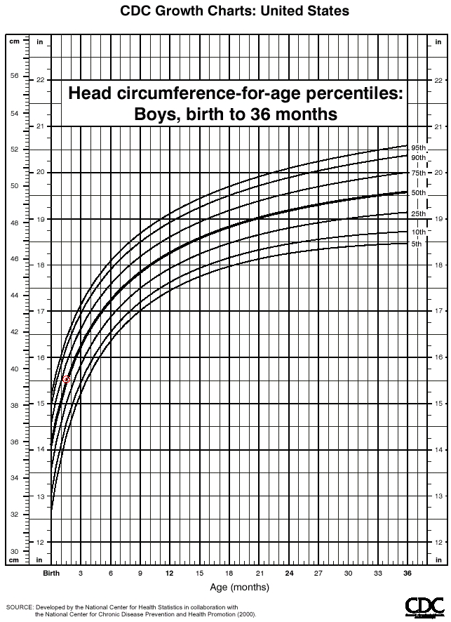 6 week checkup and Toren now has superhuman powers! – Ryan and Debi & Toren